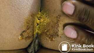 Sleeping GF dirty asshole for cleaning