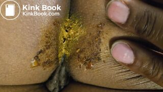 Sleeping GF dirty asshole for cleaning