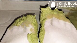 sexy chinese feet full of scat in pantyhose 2