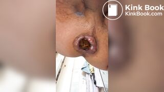 a guy pisses and shits with small penis seen below