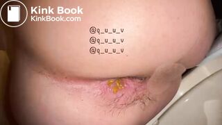 Japanese girl Yu showes her pooing