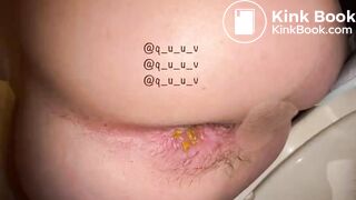 Japanese girl Yu showes her pooing