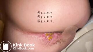 Japanese girl Yu showes her pooing