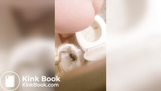 Sloppy diarrhea - video 4