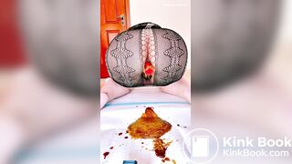 Urgent buttplug diarrhea