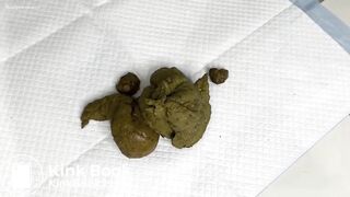 Lovely Chubby Handling Mushy Poop