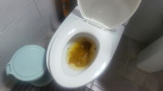 Diarrhea toilet - video 20