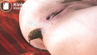 Girl pissing and shitting in frontal - video 2