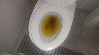 Liquid diarrhea toilet part 2