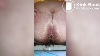 Is this IBS?