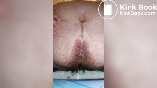 Is this IBS?