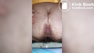 Is this IBS?