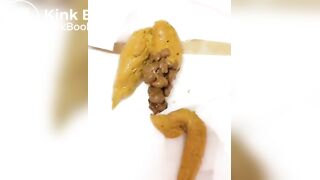 cacca gialla gialla gialla