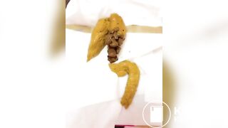 cacca gialla gialla gialla