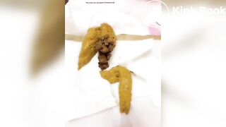 cacca gialla gialla gialla