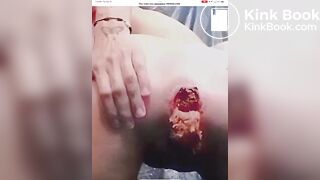 Mierda - video 44