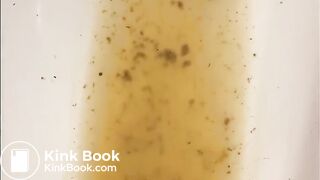 Girl walking in her diarrhea in socks