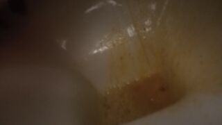 devastating liquid diarrhea