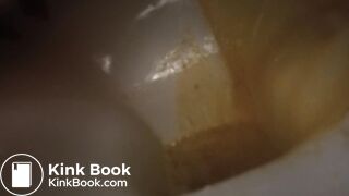 devastating liquid diarrhea