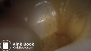 devastating liquid diarrhea
