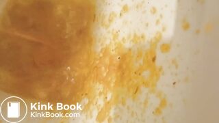 Total splatter of diarrhea!