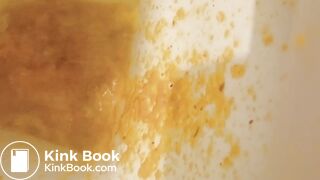 Total splatter of diarrhea!