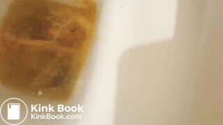 Total splatter of diarrhea!