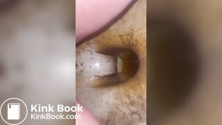 Milf argentina diarrea