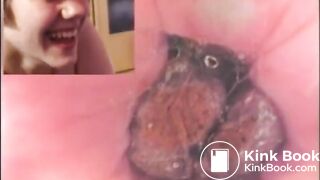 Check my poop