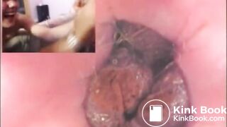Check my poop