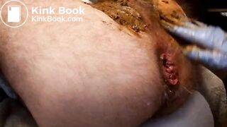 Amateur scat games - video 7