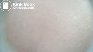 EXPLOSIVE DIARRHEA BIO TOILET