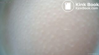 EXPLOSIVE DIARRHEA BIO TOILET