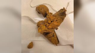 Shitting On Toilet Lid