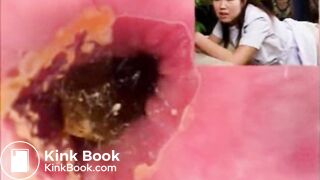 Rectal examination of a Japanese nurse