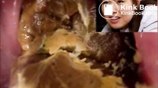 Rectal examination of a Japanese nurse