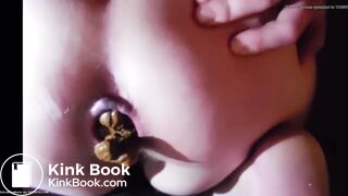 Constipated teen severe constipation struggling to poop