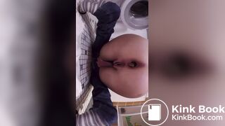 huge turd stuck in her bowels