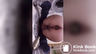 huge turd stuck in her bowels