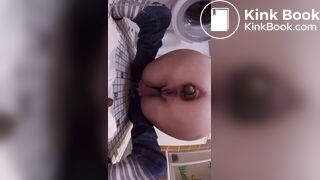 huge turd stuck in her bowels