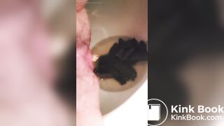 Unstoppable huge poop