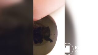 Unstoppable huge poop
