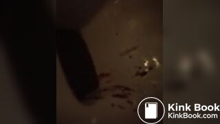 gurgling bowel and...