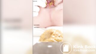 Chinese girl spread asshole scat - video 2