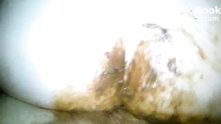 Grimy shitfuck with the flash on