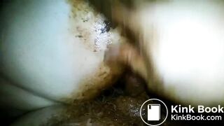 Grimy shitfuck with the flash on