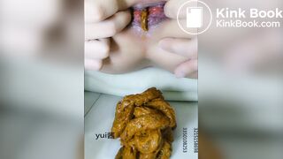 Chinese girl spread asshole scat