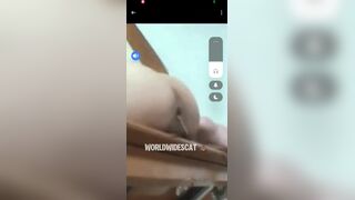 mixed diarrhea 1