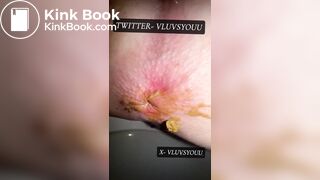 White Teen Shows Her Asshole