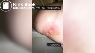 White Teen Shows Her Asshole